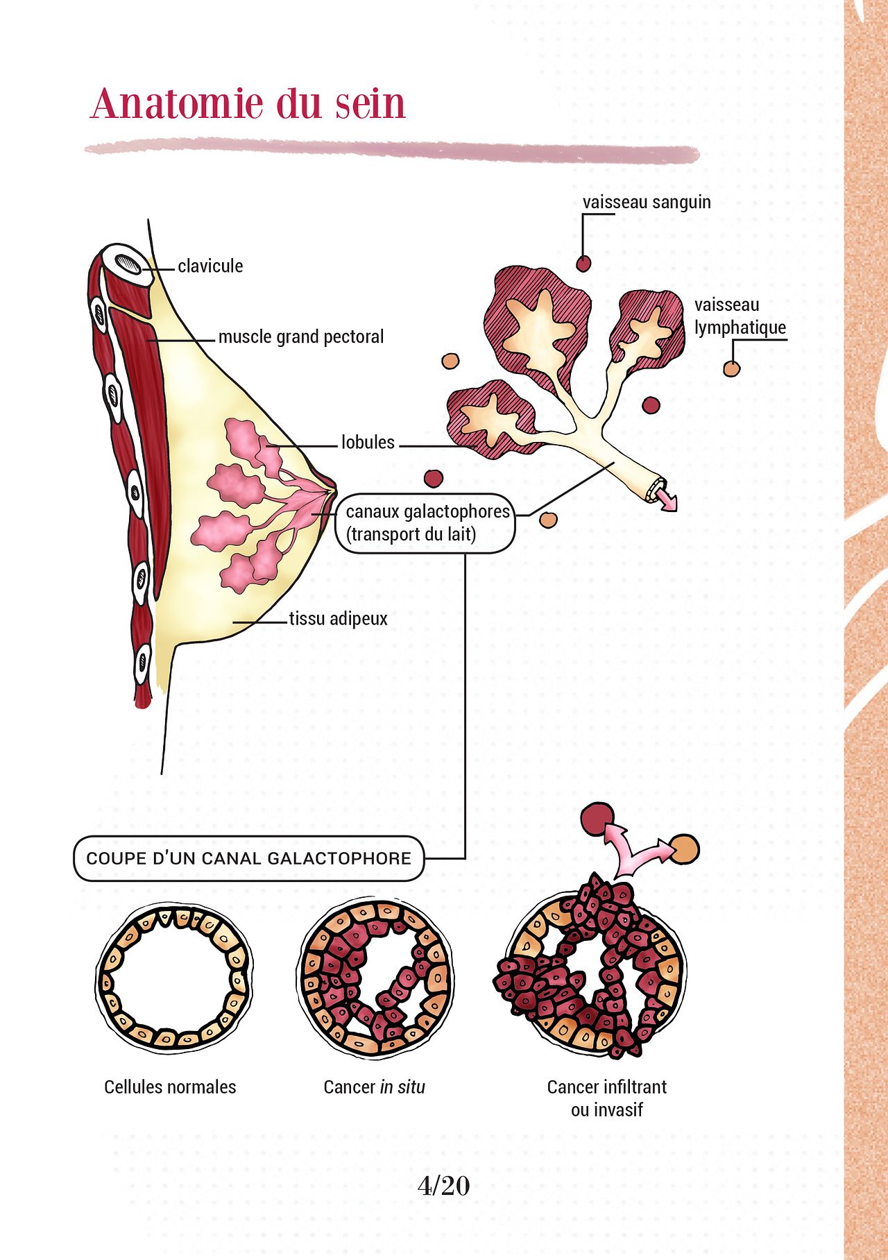 Sensibilisation cancer du sein