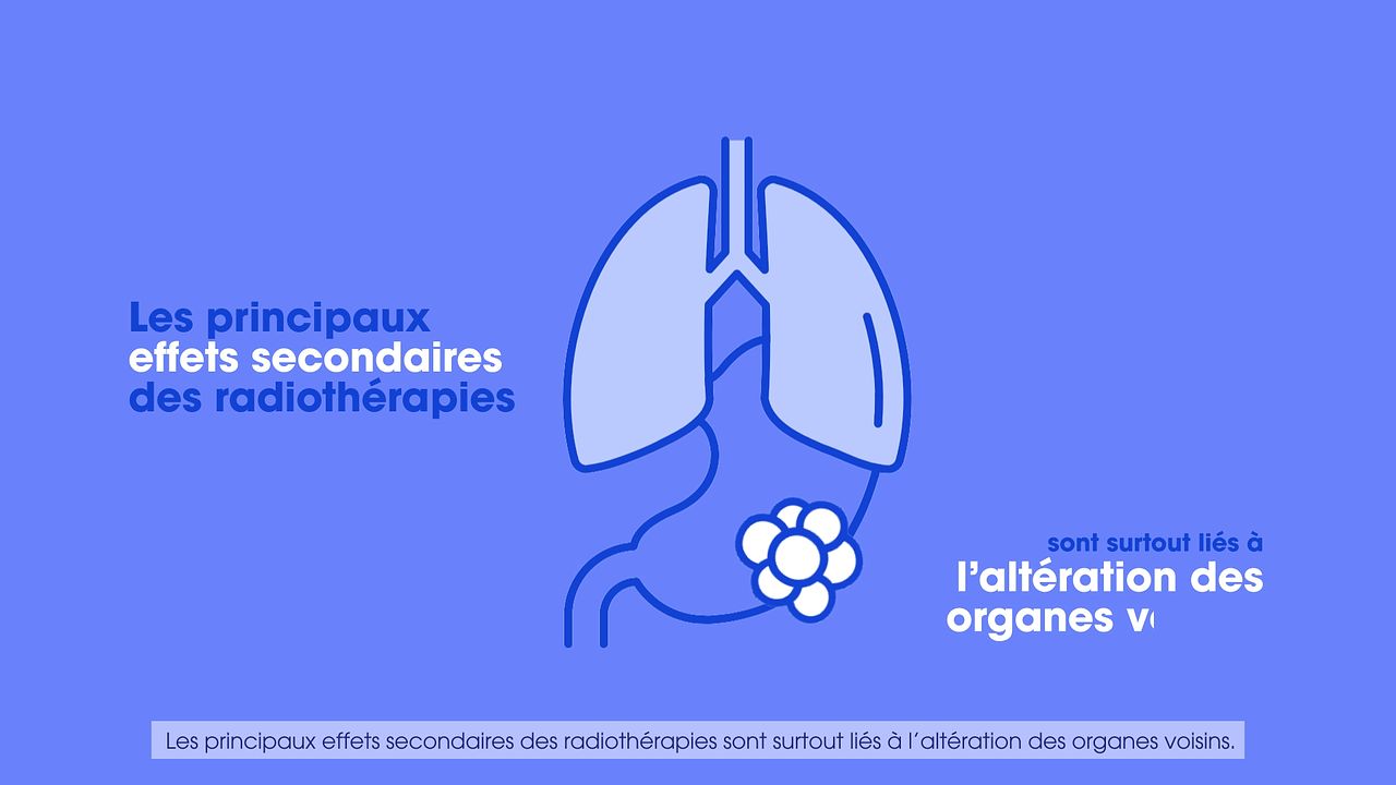 Motion design MNH campus cours anticancereux